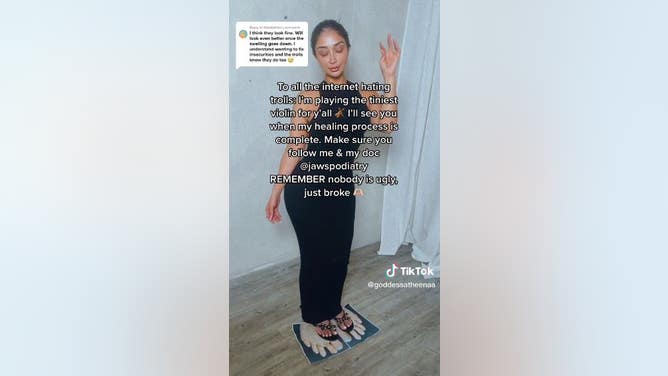 Influencer Athena Gets Trolled After Undergoing Toe-Shortening Surgery