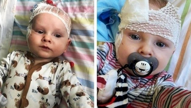 Baby Olympic medal auction heart surgery