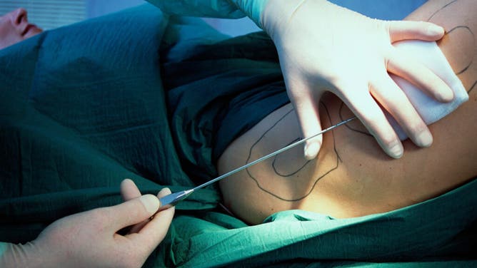 Boyfriend made his girlfriend get plastic surgery before proposing
