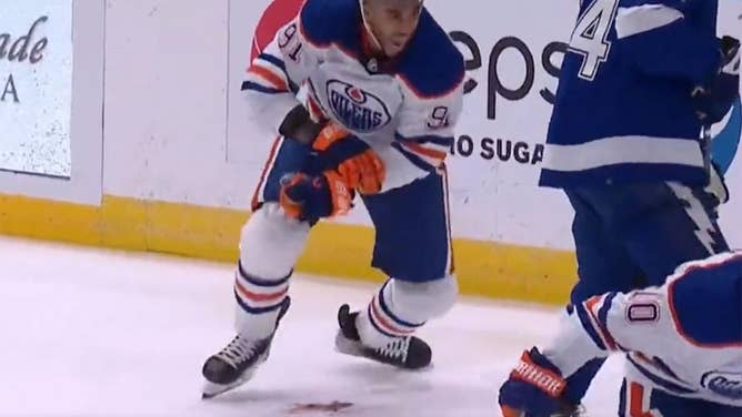 Kane injury