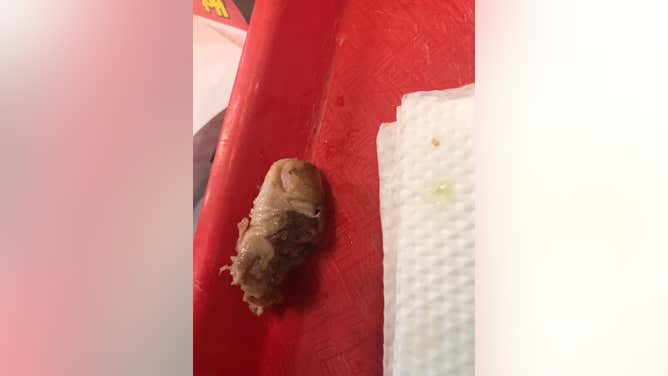 Human finger found inside a hamburger by a woman in Bolivia
