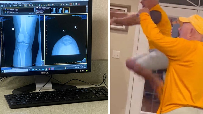 Tennessee Vols fan ACL