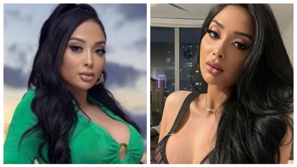 Influencer Gets Trolled After Undergoing Toe-Shortening Surgery