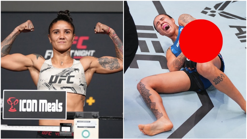 UFC fighter Istela Nunes suffered an absolutely brutal injury over the weekend. Dan White released an X-ray of her elbow injury. (Credit: Getty Images)