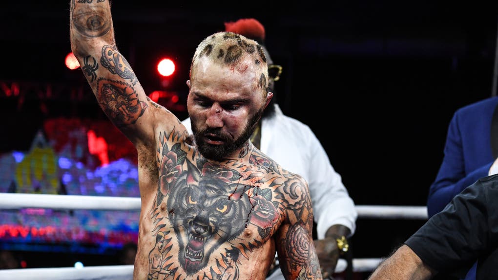 Mark the Shark Irwin head hematoma bare knuckle fighting