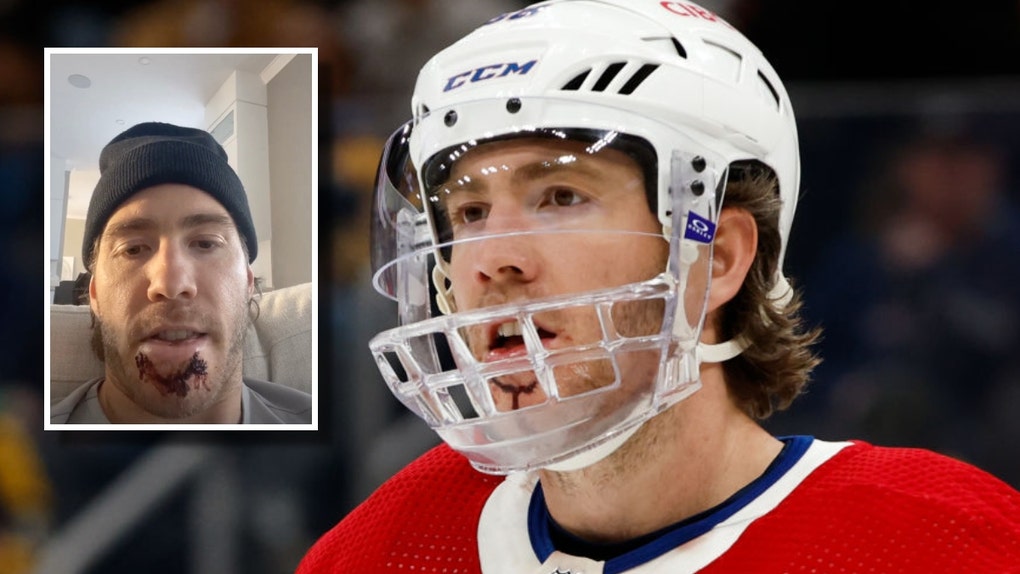 e1db4058-Mike-Hoffman