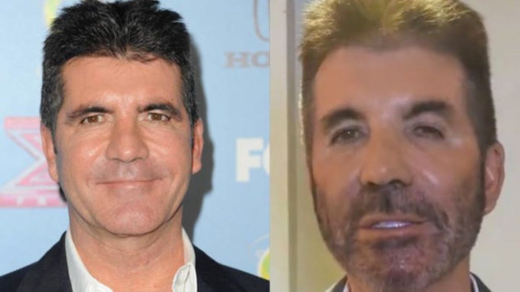 Simon Cowell new face Botox 2022 photos