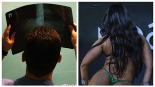 Brazilian influencer Larissa Sumpani Takes an X-Ray Of Her Perfect Butt