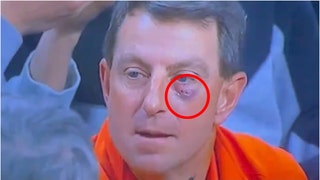 Why does Clemson football coach Dabo Swinney have a disgusting black eye? He suffered it during a basketball game. (Credit: Screenshot/X Video https://twitter.com/iam_johnw/status/1743684794452439141)