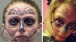 Ohio-face-tattoo-woman-tattoo-removal-lead