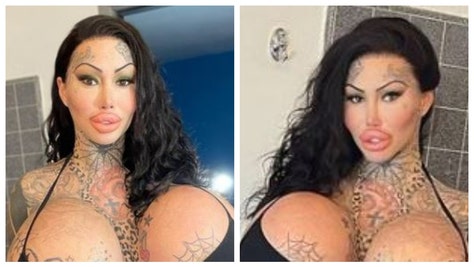 Instagram Model Calls Herself The 'Uniboob Queen' After One Of Her 38J Breast Implants Exploded