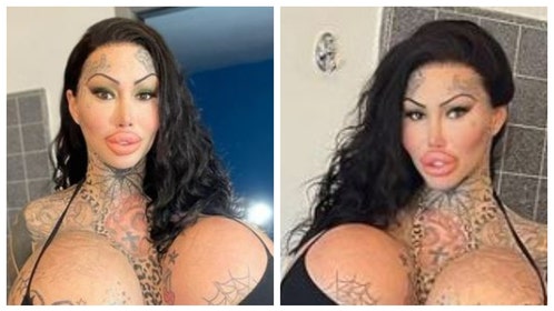 Instagram Model Calls Herself The 'Uniboob Queen' After One Of Her 38J Breast Implants Exploded