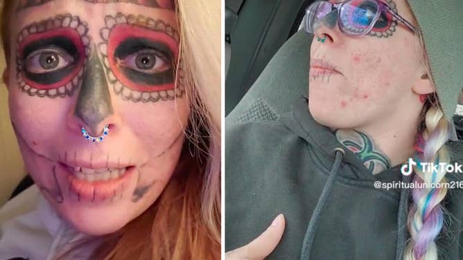 Amanda Bynes Removing Face Tattoo Ahead of Conservatorship Hearing