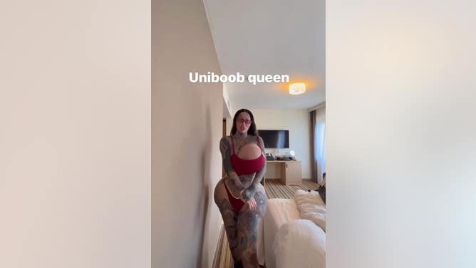 Instagram Model Calls Herself The 'Uniboob Queen' After One Of Her 38J  Breast Implants Exploded