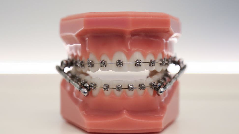 Berlin Orthodontist Manufactures Protective Masks With 3D Printer During The Coronavirus Crisis