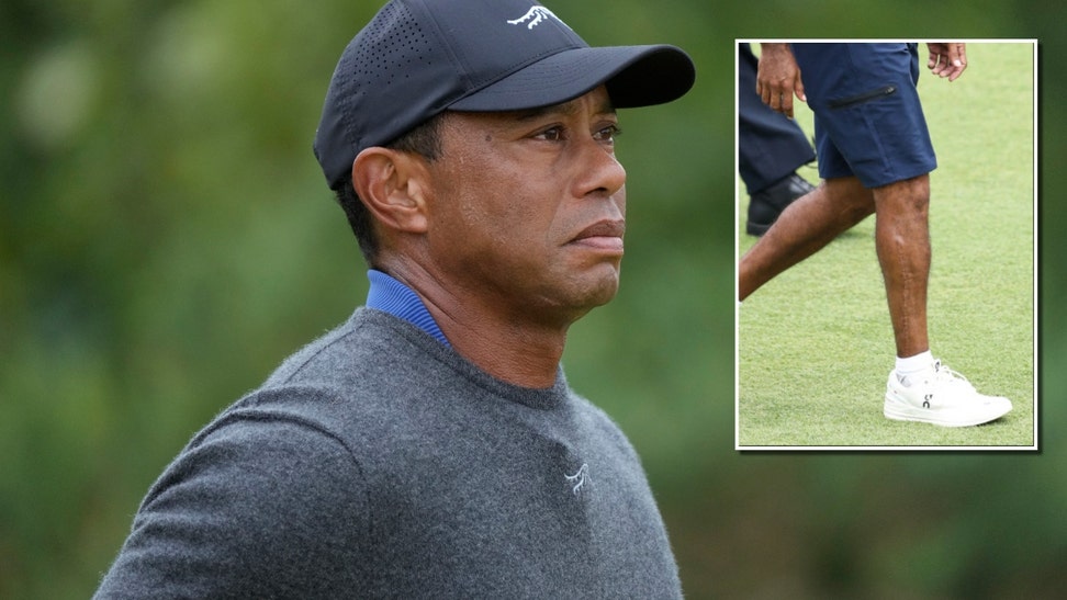 Tiger Woods Reveals His Gnarly Leg Scar For First Time Since 2021 Car Crash