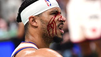 New York Knicks guard Josh Hart (3) is bloodied after taking an elbow to the eye in the first half during game five of the second round for the 2025 NBA Playoffs against the Boston Celtics at TD Garden. 