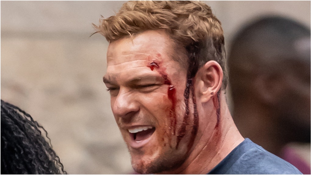 Alan Ritchson suffered black eye on the set of "Reacher" season four. (Credit: Photo by Gilbert Carrasquillo/GC Images)