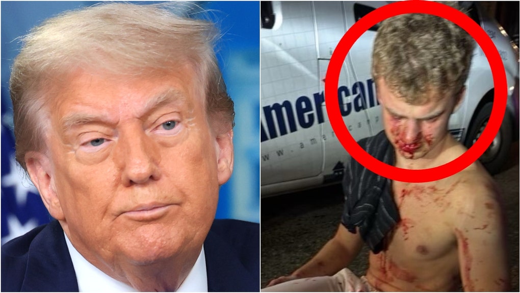 President Donald Trump slammed crime in Washington, D.C. after a violent attack on a former DOGE staffer known as "Big Balls." What details are known about the attack? (Photo by Joe Raedle/Getty Images and Donald Trump/Truth Social)