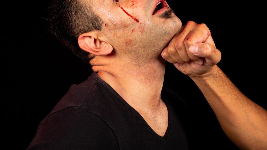 mma fighter kicks home intruder's ass leaves him bruised up for mugshot