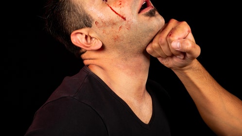 mma fighter kicks home intruder's ass leaves him bruised up for mugshot